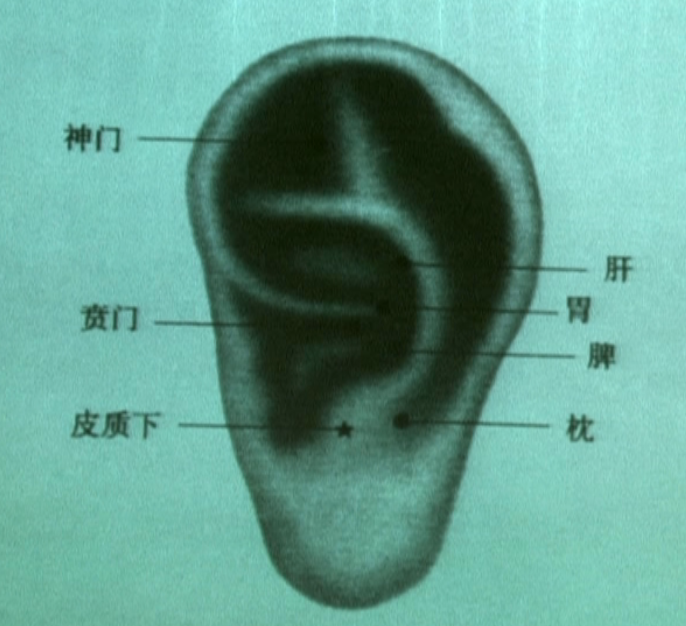耳穴治疗闭经的穴位