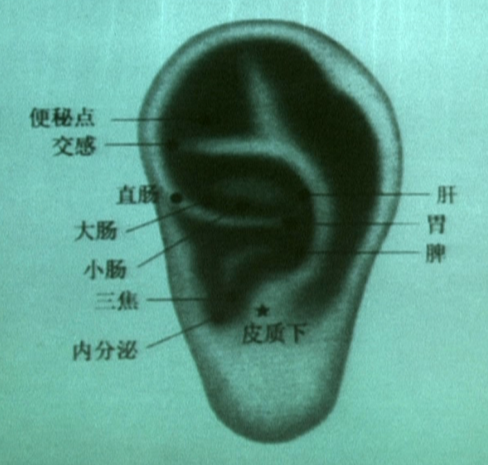耳穴治疗便秘的穴位