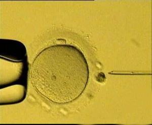 小鼠显微授精新技术--人类ICSI技术动物
