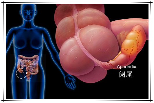 急性阑尾炎,以转移性右下腹痛为主要临床表现