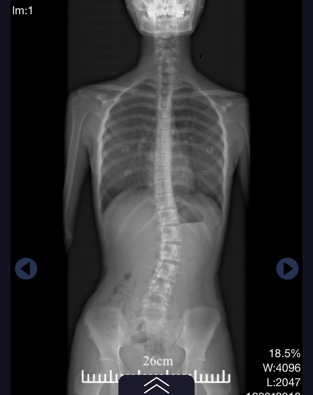 2026-03-13 230233000.jpg