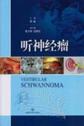 听神经瘤 