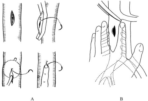 pagenumber_ebook=259,pagenumber_book=244