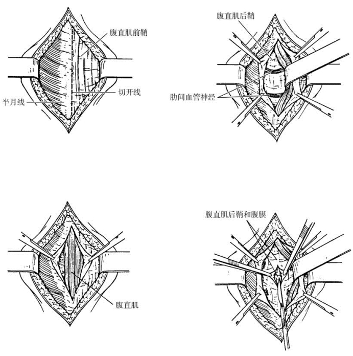 pagenumber_ebook=543,pagenumber_book=528