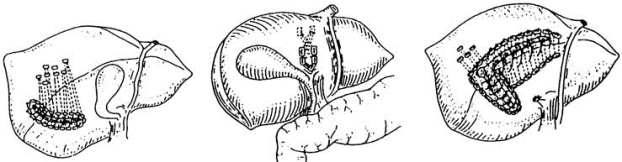 pagenumber_ebook=575,pagenumber_book=560