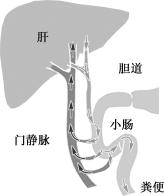 width=143,height=171,dpi=110