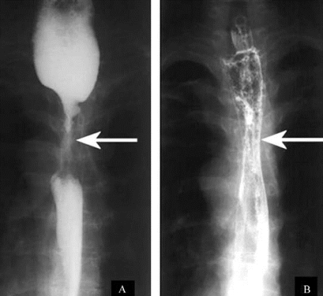 pagenumber_ebook=294,pagenumber_book=279