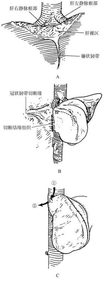 pagenumber_ebook=471,pagenumber_book=456
