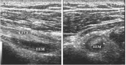 pagenumber_ebook=748,pagenumber_book=748