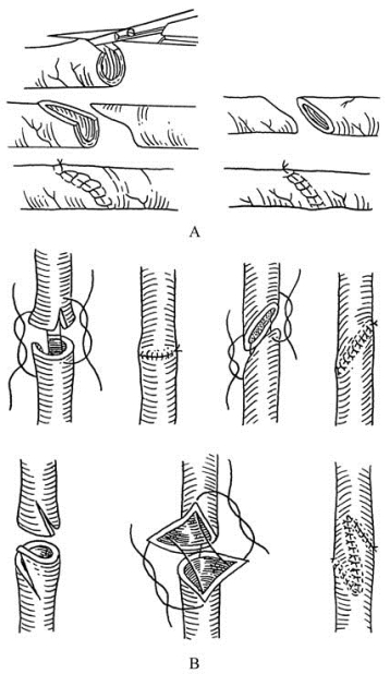 pagenumber_ebook=242,pagenumber_book=227