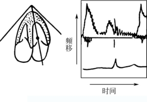 pagenumber_ebook=33,pagenumber_book=33