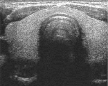 pagenumber_ebook=159,pagenumber_book=159