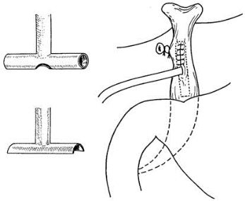 pagenumber_ebook=440,pagenumber_book=425