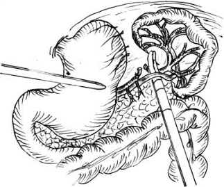 pagenumber_ebook=515,pagenumber_book=500