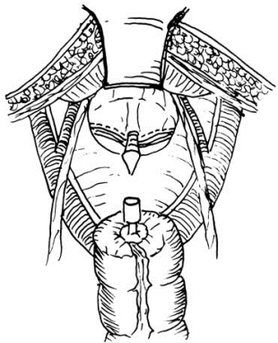 pagenumber_ebook=421,pagenumber_book=406