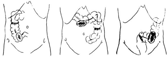 pagenumber_ebook=571,pagenumber_book=556