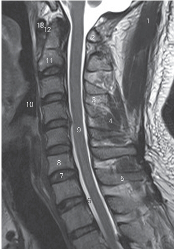 pagenumber_ebook=14,pagenumber_book=5