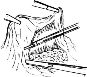 pagenumber_ebook=357,pagenumber_book=342