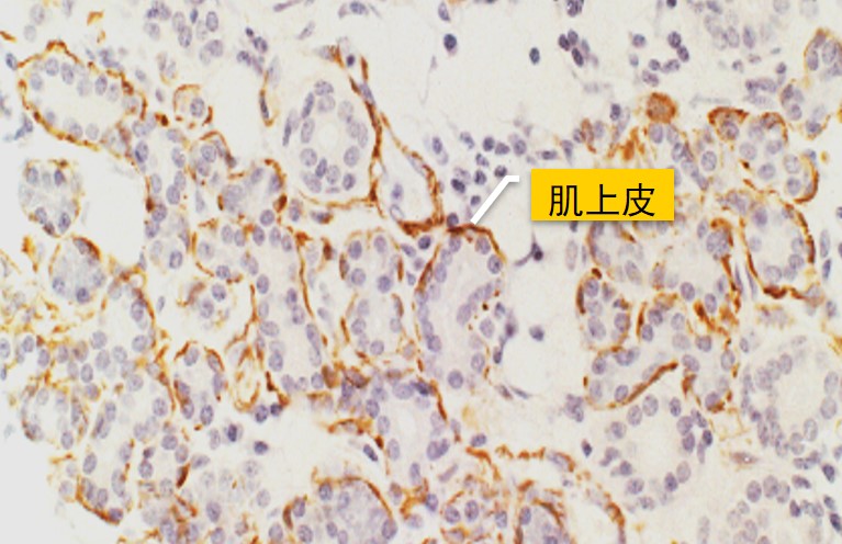 6.1-8 肌上皮细胞.jpg