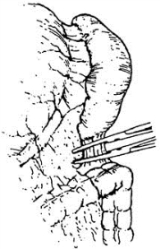 pagenumber_ebook=508,pagenumber_book=493