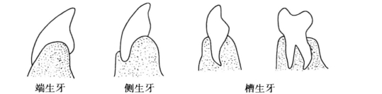 pagenumber_ebook=13,pagenumber_book=4