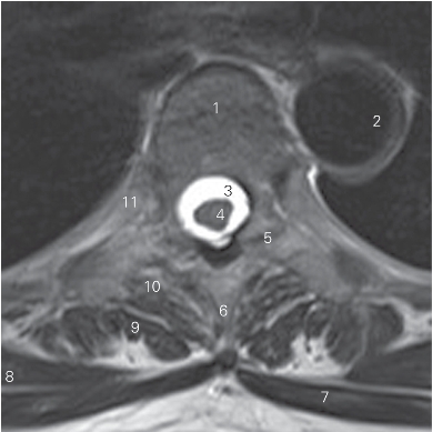 pagenumber_ebook=20,pagenumber_book=11