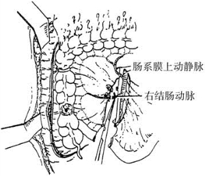 pagenumber_ebook=194,pagenumber_book=179