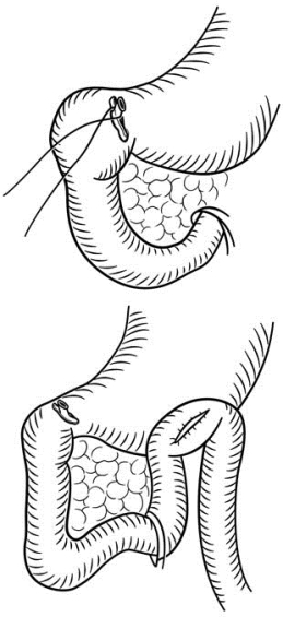 pagenumber_ebook=567,pagenumber_book=552