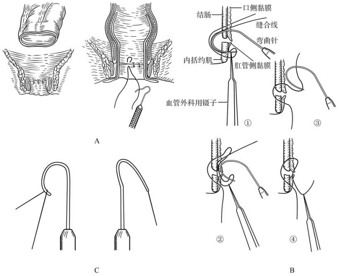 pagenumber_ebook=140,pagenumber_book=125