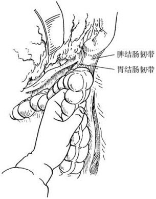 pagenumber_ebook=392,pagenumber_book=377