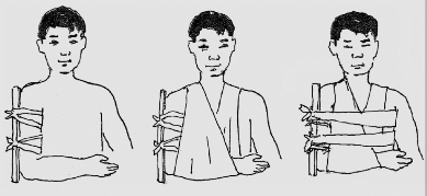 pagenumber_ebook=92,pagenumber_book=79