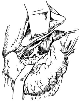 pagenumber_ebook=361,pagenumber_book=346