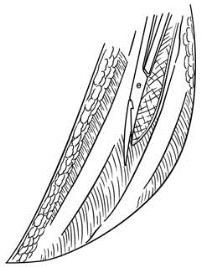 pagenumber_ebook=318,pagenumber_book=303