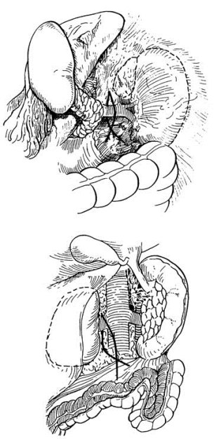 pagenumber_ebook=561,pagenumber_book=546