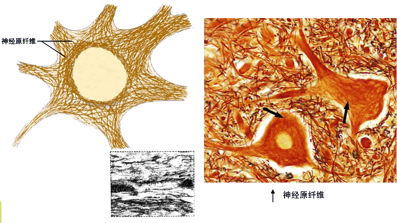 神经原纤维.jpg