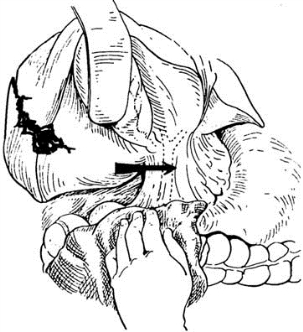 pagenumber_ebook=573,pagenumber_book=558