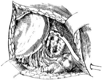 pagenumber_ebook=504,pagenumber_book=489