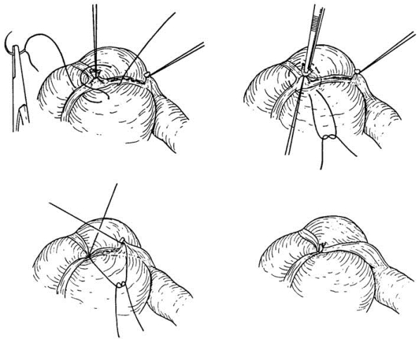 pagenumber_ebook=546,pagenumber_book=531