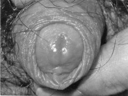 pagenumber_ebook=79,pagenumber_book=68