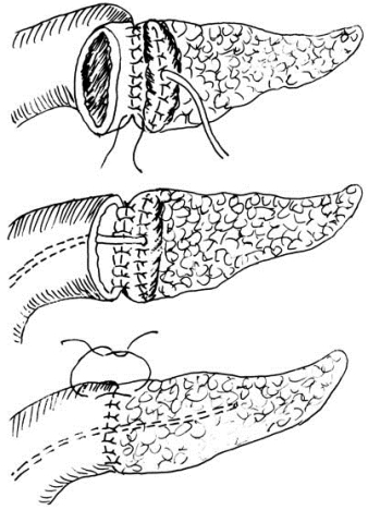 pagenumber_ebook=533,pagenumber_book=518