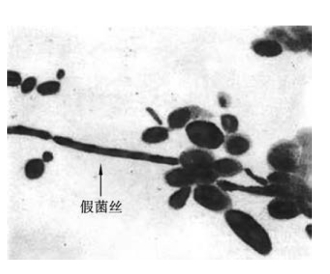 pagenumber_ebook=116,pagenumber_book=109