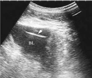 pagenumber_ebook=635,pagenumber_book=635