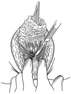 pagenumber_ebook=412,pagenumber_book=397