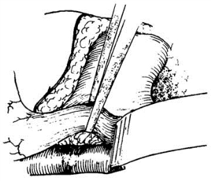 pagenumber_ebook=319,pagenumber_book=304