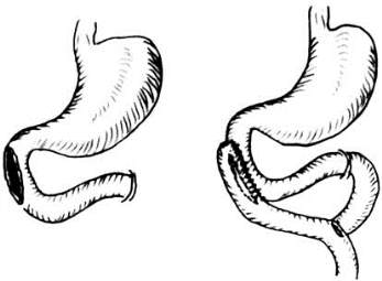 pagenumber_ebook=566,pagenumber_book=551