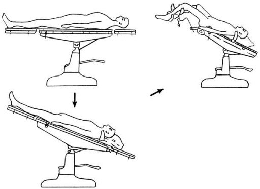 pagenumber_ebook=72,pagenumber_book=57