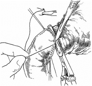 pagenumber_ebook=327,pagenumber_book=312