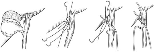 pagenumber_ebook=231,pagenumber_book=216