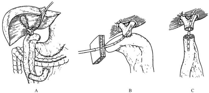 pagenumber_ebook=455,pagenumber_book=440