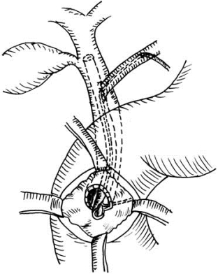 pagenumber_ebook=537,pagenumber_book=522